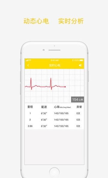 红豆心电衣  v2.0.0图2